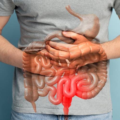 maladie du système digestif, crohn